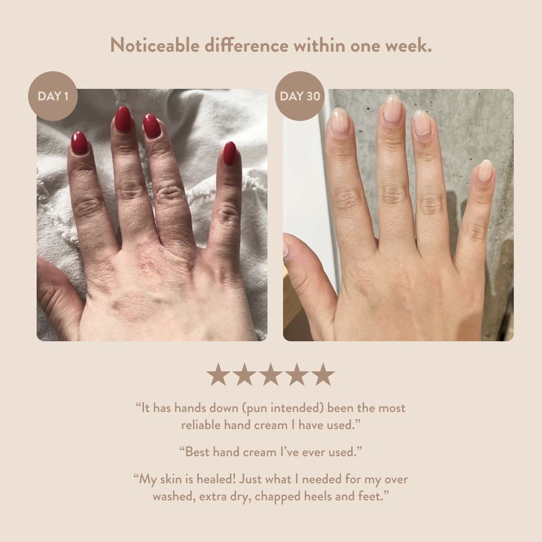 Overnight Hand & Foot Hydration Mask: 1oz